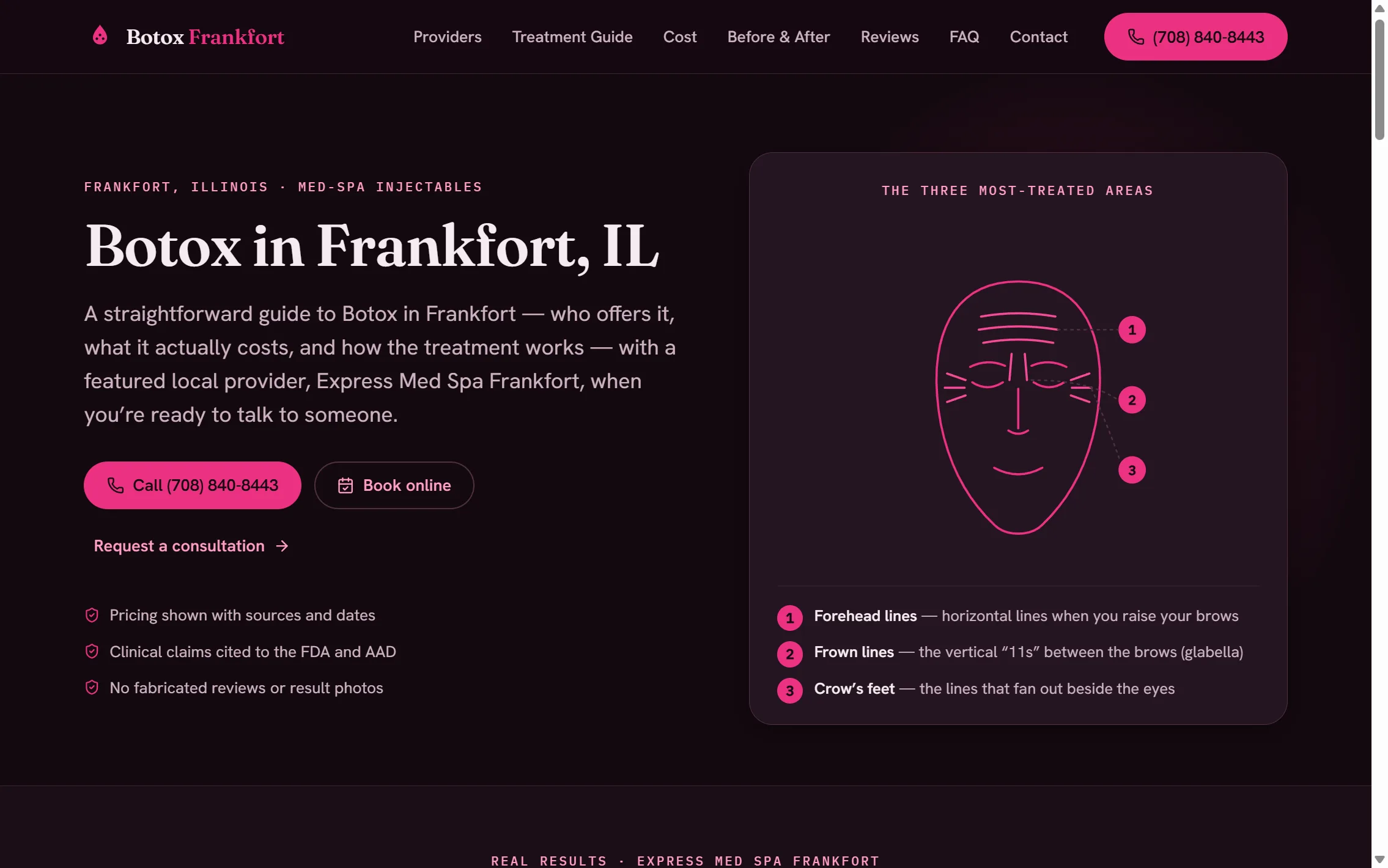 Botox Frankfort IL — website by The Search Sherpa